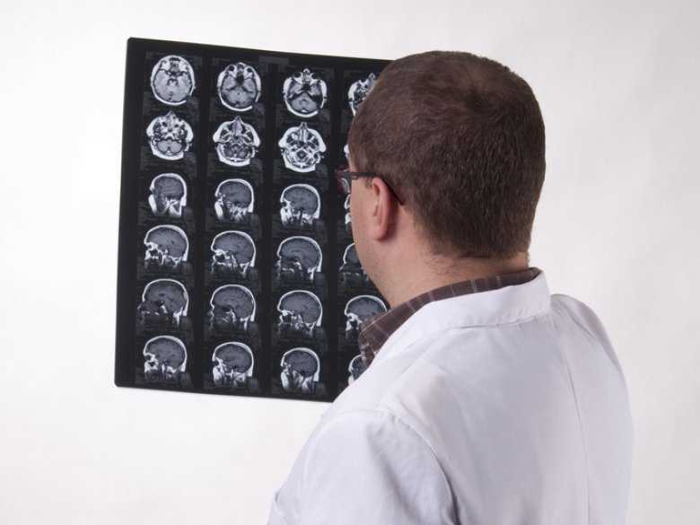Neuroobrazowanie w psychiatrii