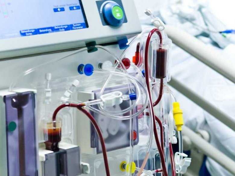 Częstość zakażeń wirusem HCV u pacjentów poddawanych w dzieciństwie transfuzjom krwi