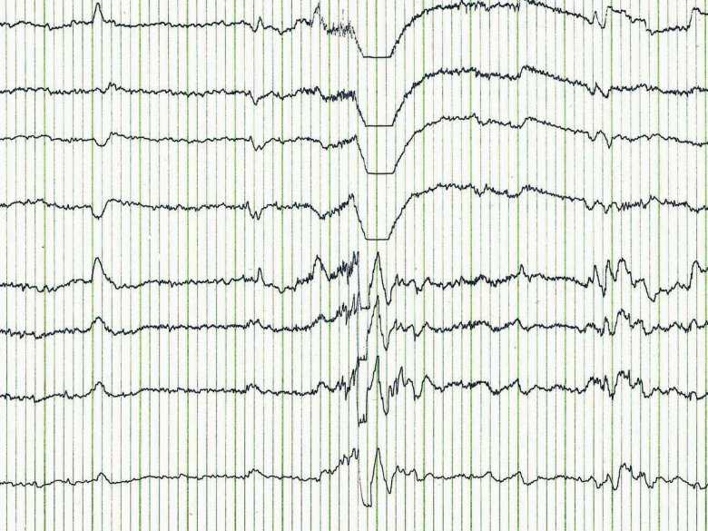 Charakterystyka metod neurotechnologicznych w praktyce medycznej