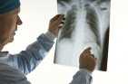x-ray