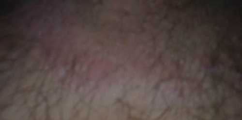 noga