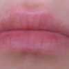 zajady