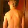 moj syn po adenotomi moj syn po adenotomi