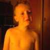 moj syn po adenotomi 2