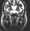 diagnoza1