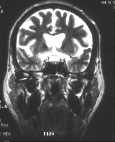 diagnoza1