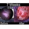 7week_before_and_after