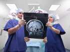 Migrena a przezczaszkowa bezpośrednia stymulacja prądowa