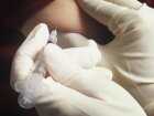 Szczepienie przeciwko gruźlicy - nadmierny odczyn po szczepieniu