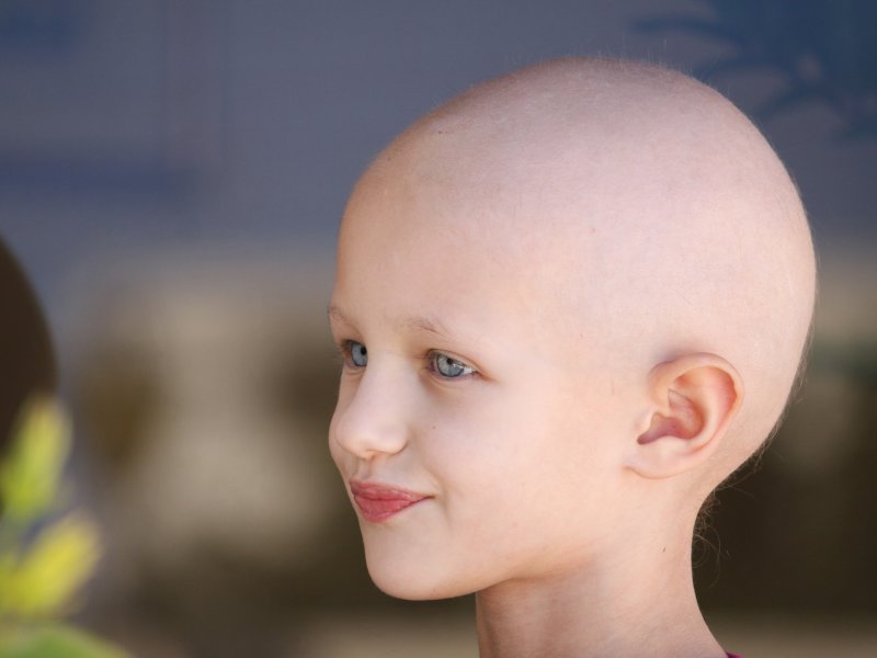Białaczka u dziecka
