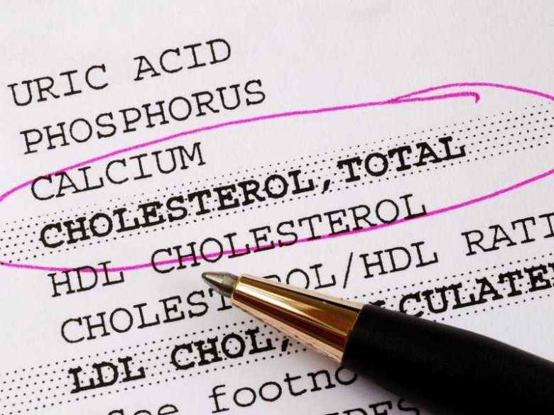 Badanie poziomu cholesterolu