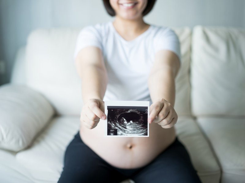 Kobieta w ciąży trzymająca zdjęcie usg