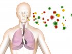 Zapalenie płuc - różne rodzaje