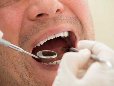 Bezwiertłowe leczenie zębów