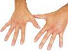 Czy mrowienie rąk jest niebezpieczne?