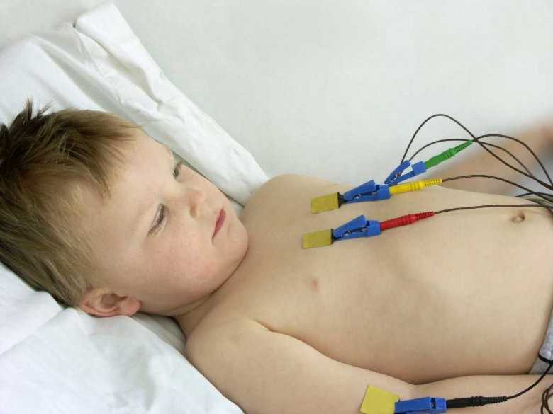 EKG wykonywane wśród dzieci