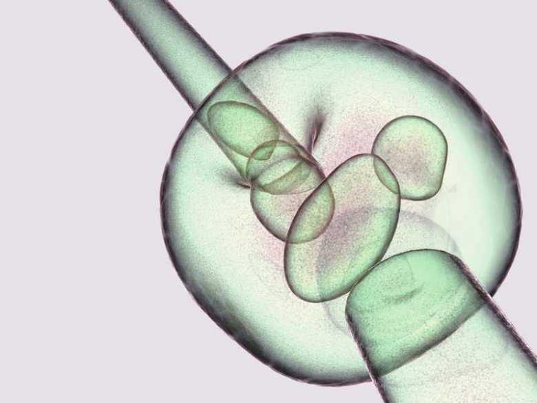 Zapłodnienie in-vitro