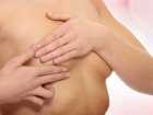 Rak piersi - przyczyny, objawy, diagnoza, leczenie, metody leczenia operacyjnego