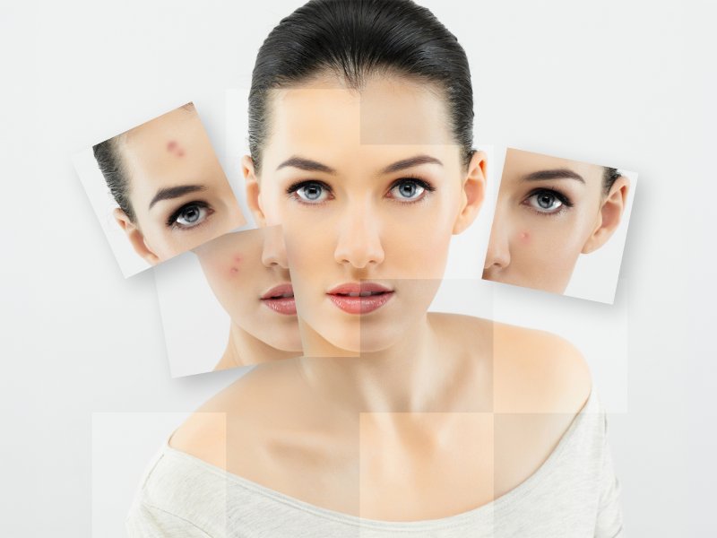 Schizofrenia