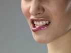 Objawy raka jamy ustnej