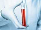 Jak prawidłowo przygotować się do badania krwi?