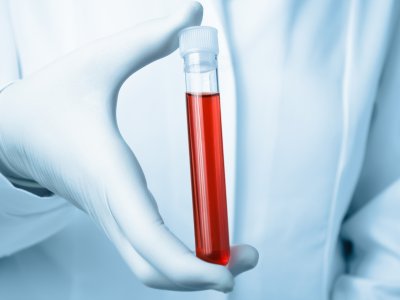 Test z krwi szansą na wczesne wykrycie nowotworów