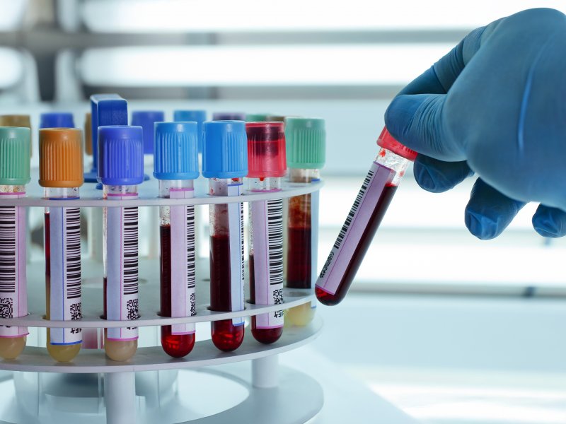 Badanie próbek krwi w laboratorium