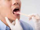 Pieczenie języka: przyczyną może być gorący napój, ale i... uczulenie lub cukrzyca!