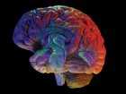 Zapalenie mózgu - objawy, diagnoza, leczenie