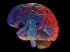 Niedotlenienie mózgu - definicja i przyczyny