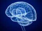 Udar mózgu - objawy, jak rozpoznać