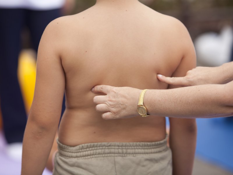 Tkanka tłuszczowa u dziecka