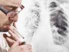 Rak płuc - dlaczego wciąż zabija tylu z nas?