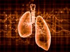 Rak płuca – epidemiologia i objawy