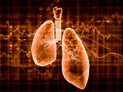 Rak płuca – diagnostyka