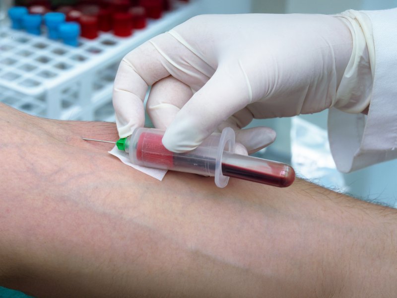 Pobieranie krwi