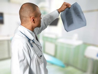 Zmiany w programie lekowym dla chorych z rakiem płuc