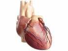 Tętniak pozawałowy serca