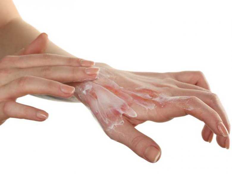 Poparzenie ręki