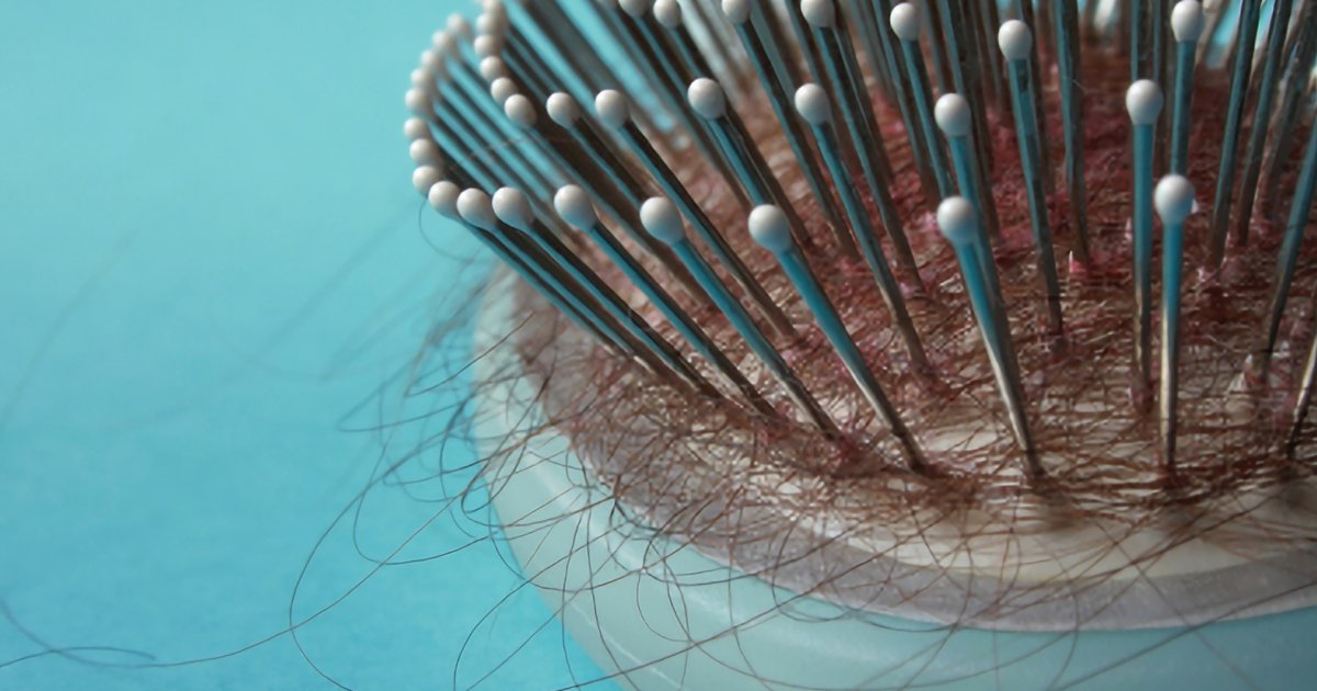 Wypadanie Włosów Przyczyny Objawy Diagnoza Leczenie Forumdermatologicznepl 0920