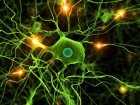 Neuralgia nerwu trójdzielnego - objawy, diagnoza, leczenie