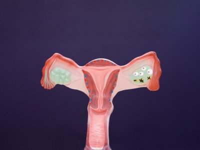 https://static2.medforum.pl/cache/logos/uklad_rozrodczy_kobiety_chemat_istock_000005724277xsmall_-W400H300.jpg