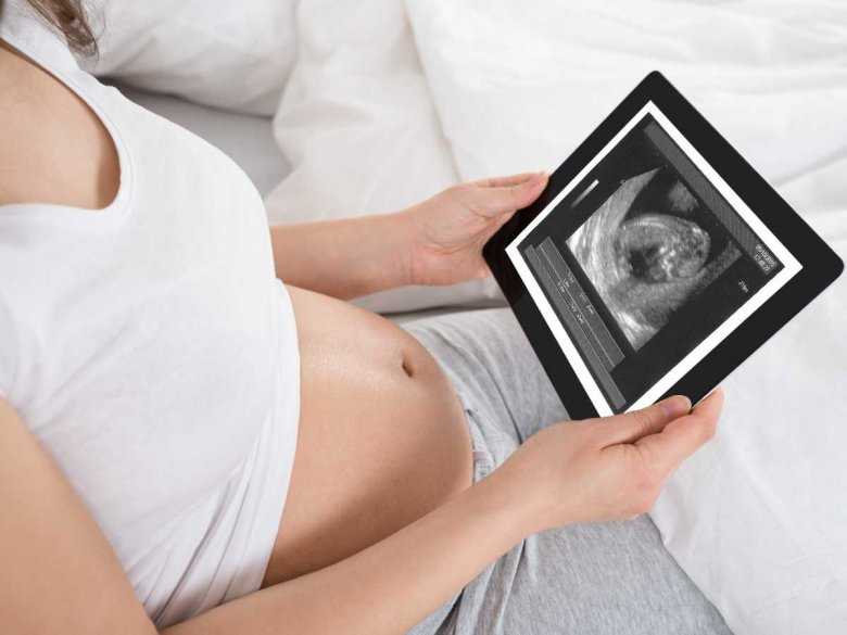 Kobieta w ciąży ze zdjęciem usg na tablecie