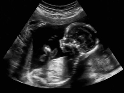 Badania prenatalne – kiedy wykonać i jak się do nich przygotować?