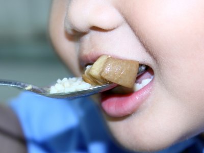 Dieta u dziecka z tendencją do wymiotów acetonemicznych
