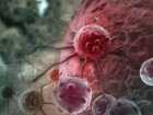 Agresywny rak trzustki i proteiny, które mogą promować jego zdolność do dawania przerzutów
