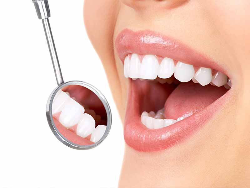 Próchnica Zębów Profilaktyka Przyczyny Objawy Diagnoza Leczenie Forumstomatologicznepl 6769
