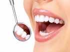 Implanty zębów - co to takiego?