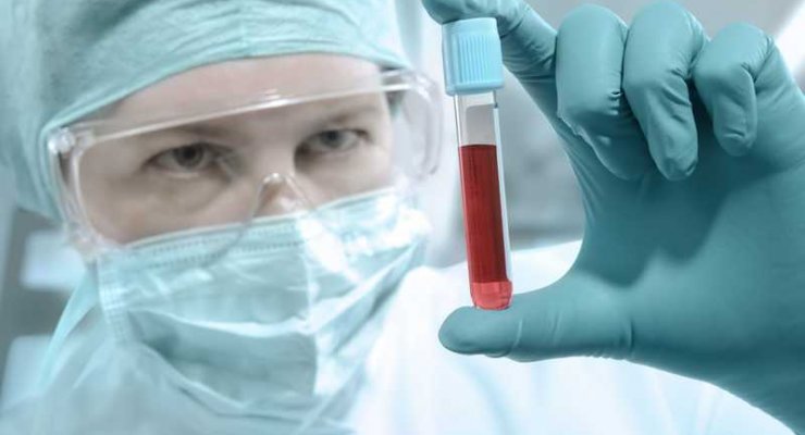 Bankowanie krwi pępowinowej