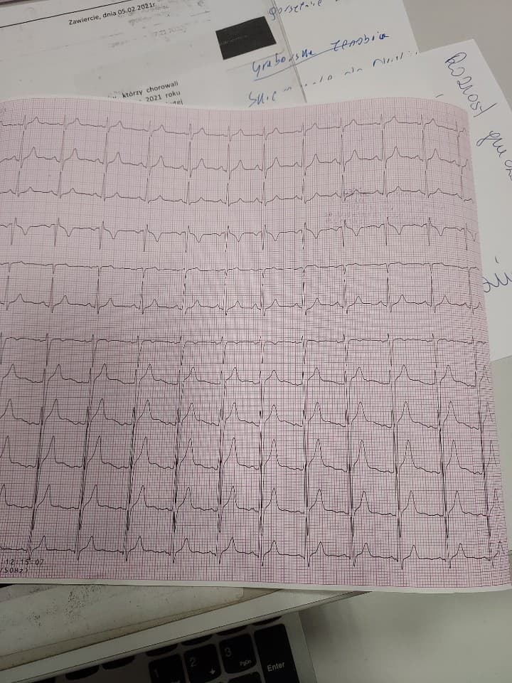 EKG - INTERPRETACJA - Kardiologia - Kardiolo.pl